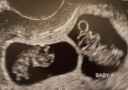The-Baby-We-Will-Never-Meet-IMAGE